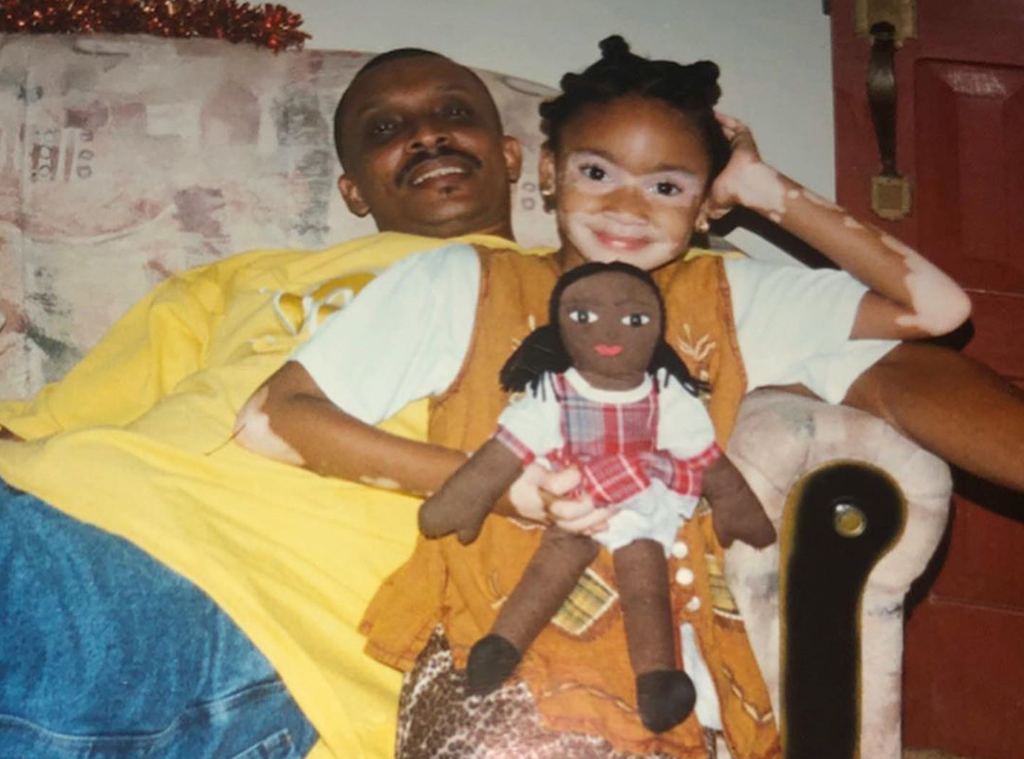 Winnie Harlow, Instagram