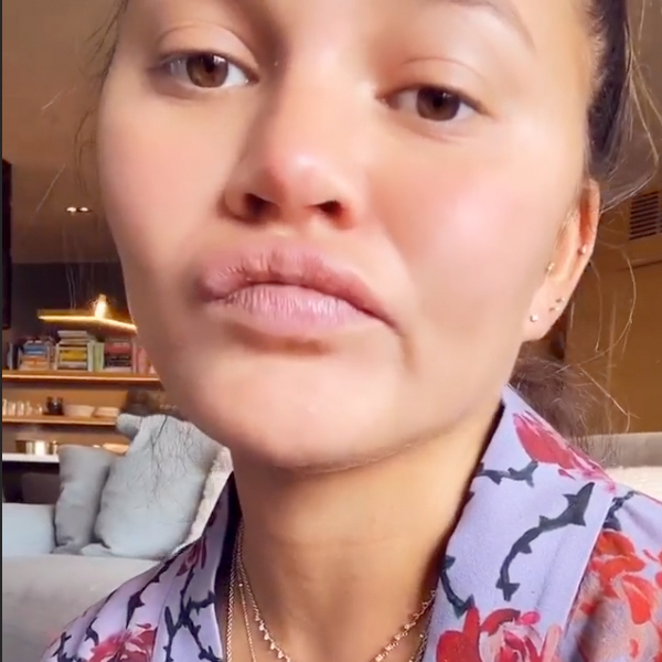 Chrissy Teigen Claims Tongue Is Falling Off After Eating Sour Candy