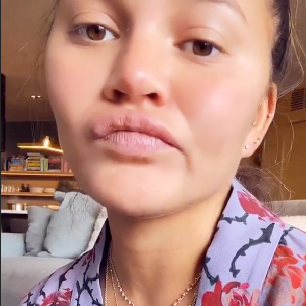 chrissy-teigen-claims-tongue-is-falling-off-after-eating-sour-candy