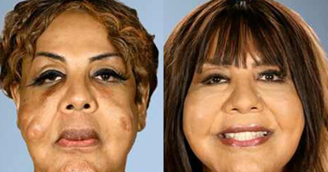 Photos from Botched Patients Before and After: Shocking Transformations ...