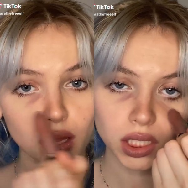 Olheiras, TikTok
