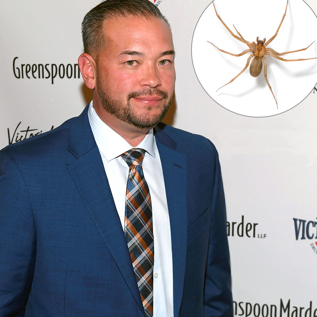 Jon Gosselin Recovering From Venomous Spider Bite That Caused
