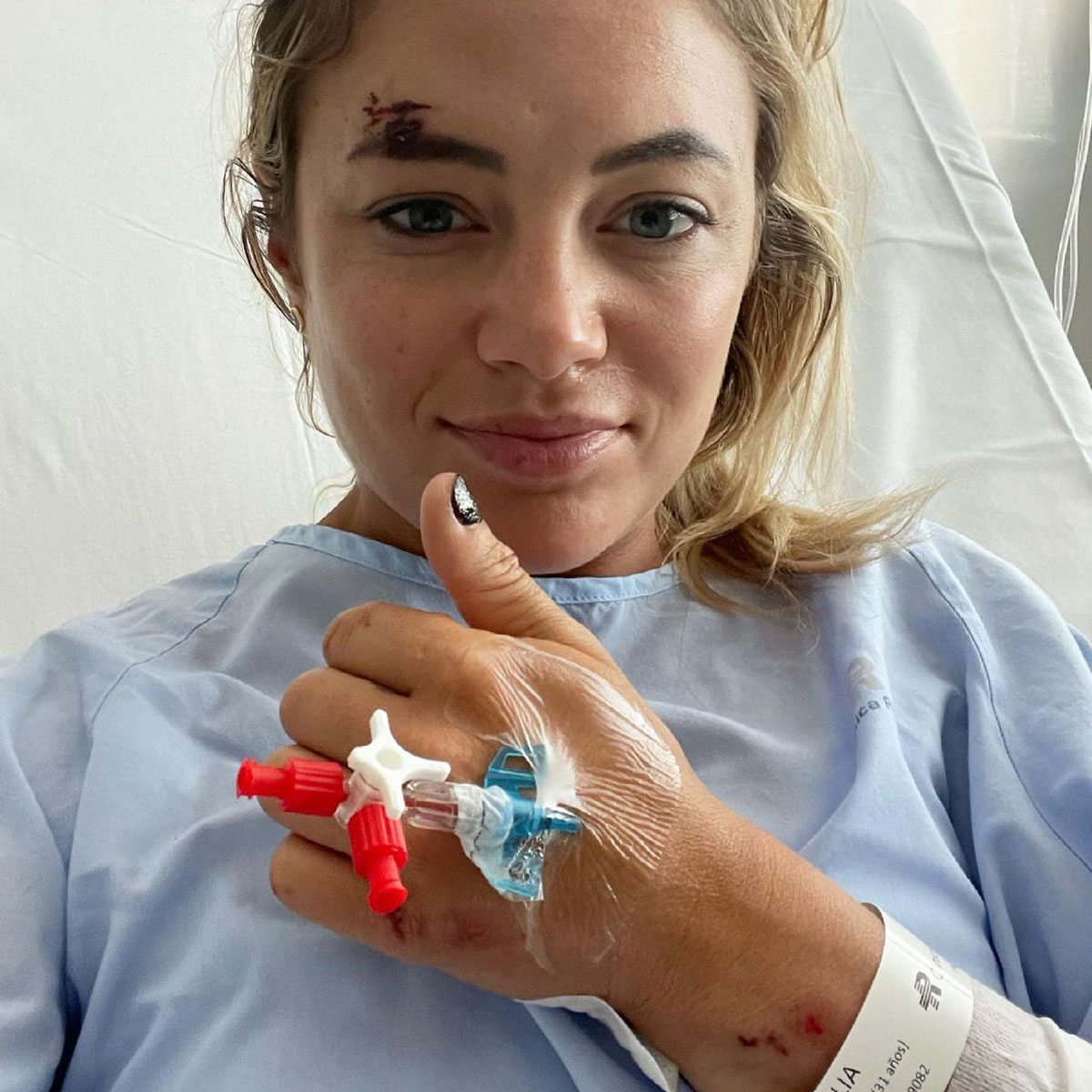 Below Deck Meds Malia White Details Mean Scooter Accident E Online 