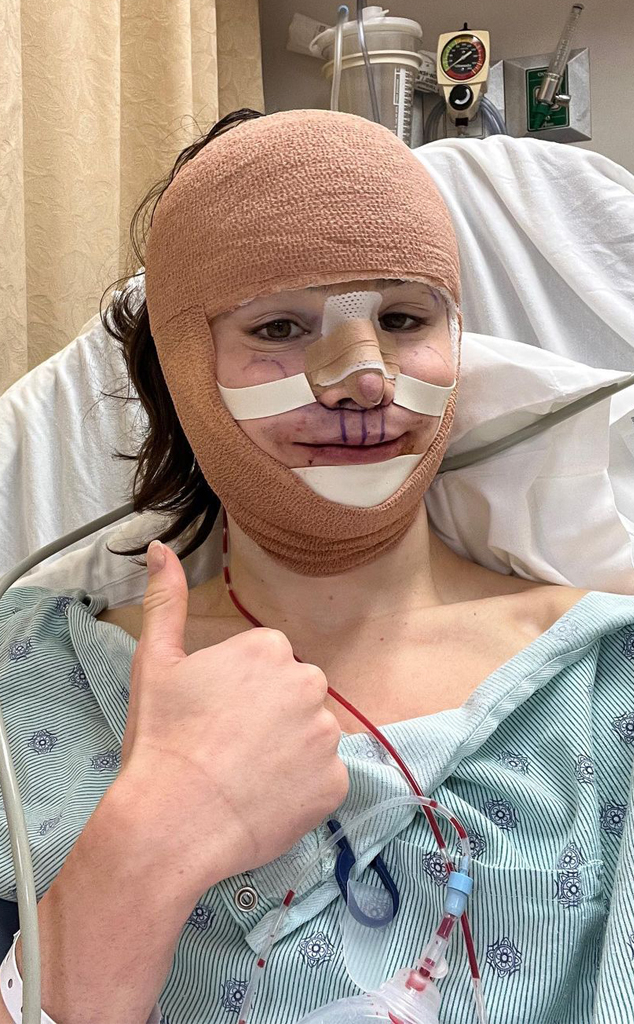 TikToker Dylan Mulvaney 'face reveals' following surgery - Attitude