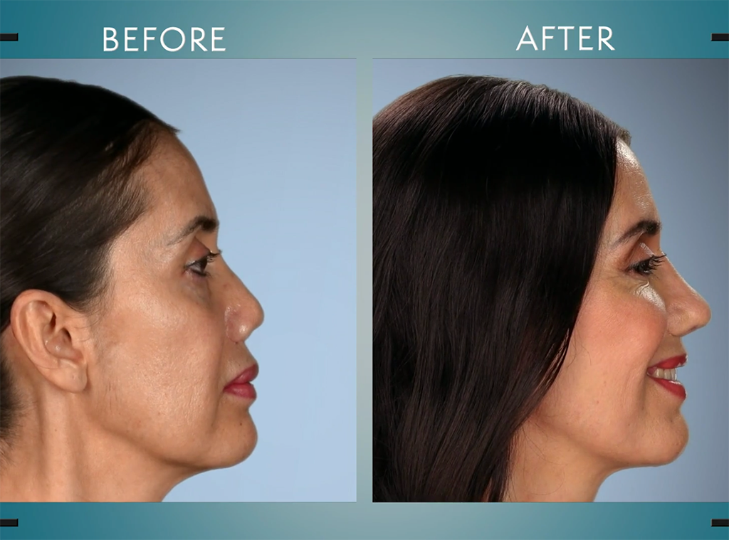 Botched By Nature' has Drs. Terry Dubrow, Paul Nassif breaking this doctor norm