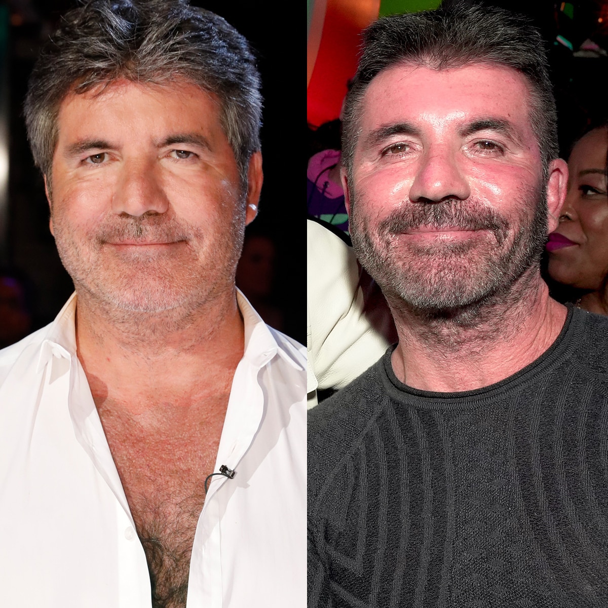 Simon Cowell Removes His Face Fillers After Saying He Went “Too Far”