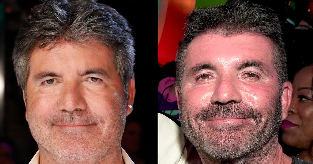 Simon Cowell Removes His Face Fillers After Saying He Went “Too Far” thumbnail
