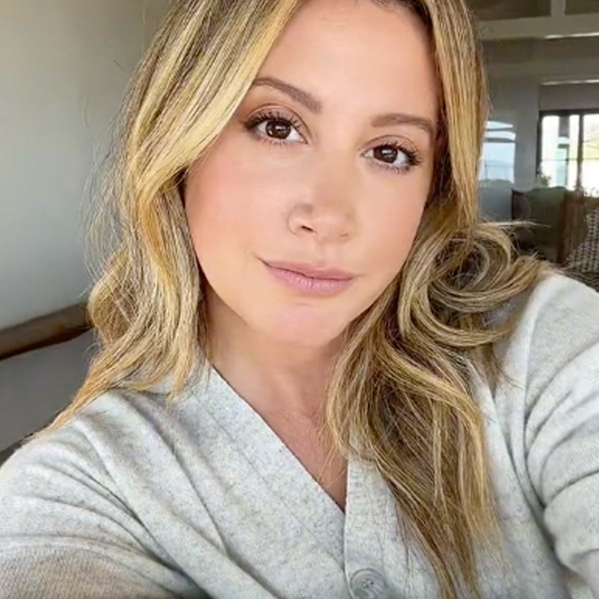Ashley Tisdale Porn Fakes Facial - Why Ashley Tisdale Decided to Share Her 10-Year Alopecia Journey - E! Online