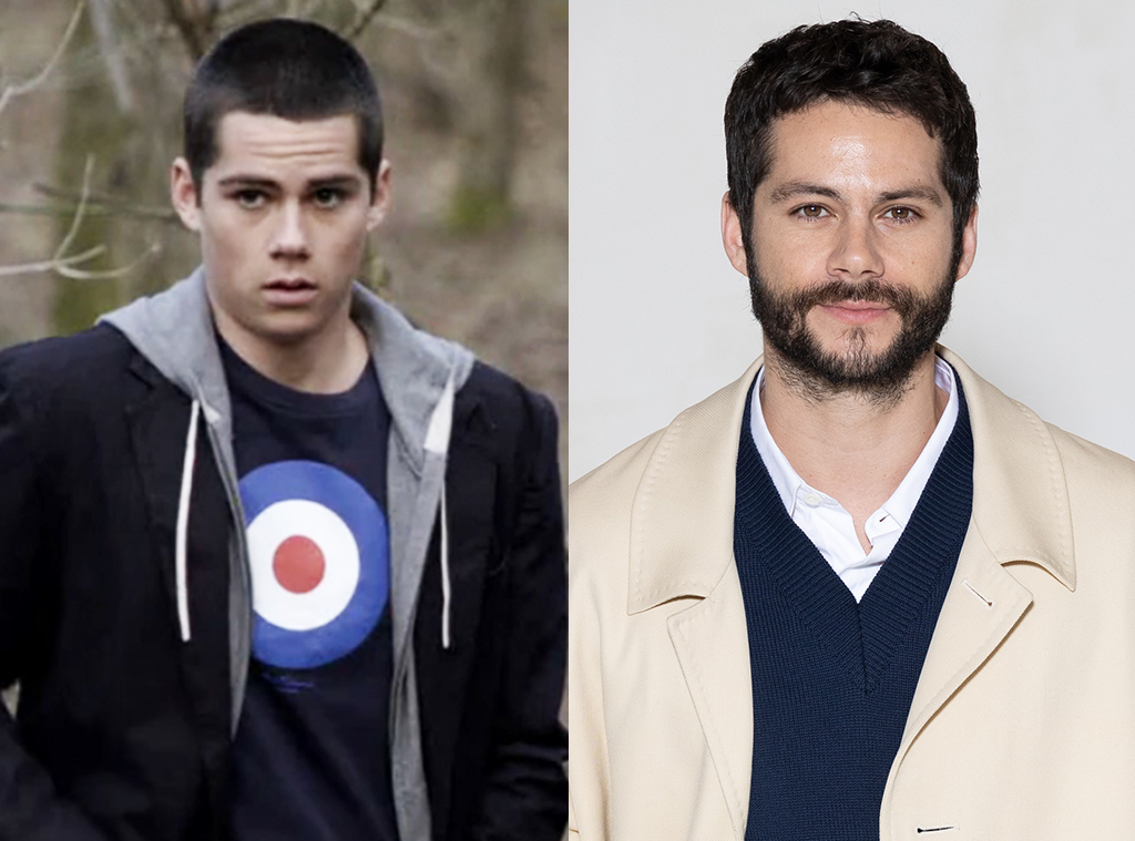 Dylan O'Brien's Transformation in Photos: 'Teen Wolf' to Now
