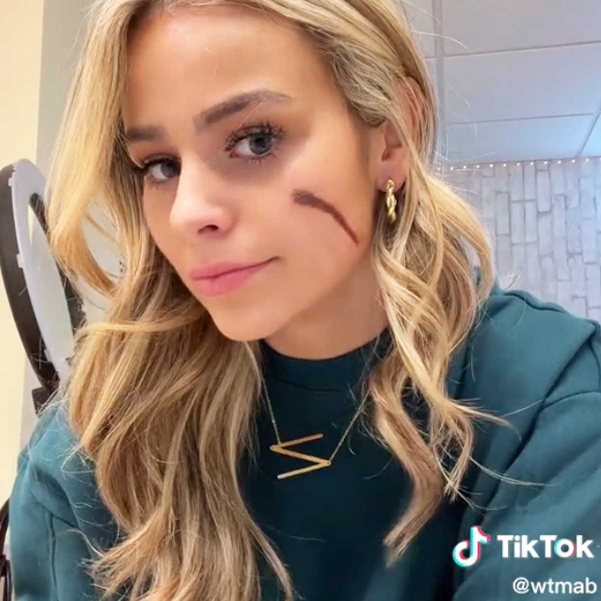 TikTok's "Scar Girl" Annie Bonelli Reacts To Claims Her Scar Is Fake