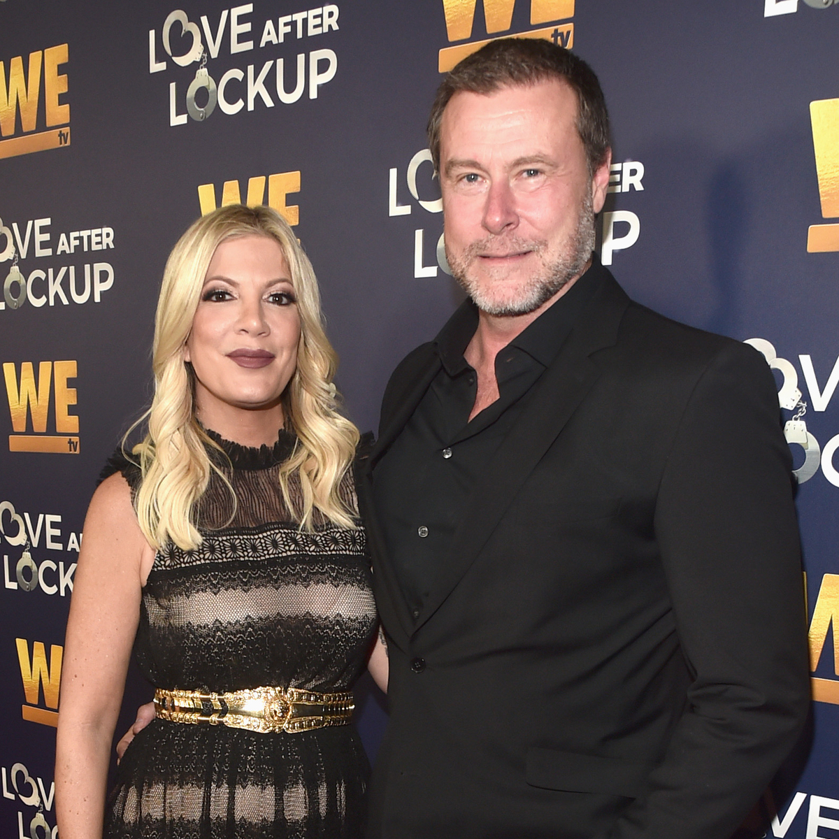 Tori Spelling and Dean McDermott’s Child Liam Undergoes Surgery