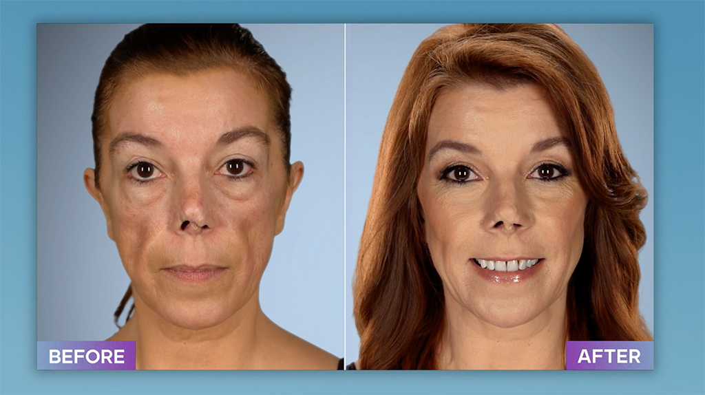 Botched': Do Dr. Dubrow and Dr. Nassif Have Their Own Plastic Surgery  Regrets?