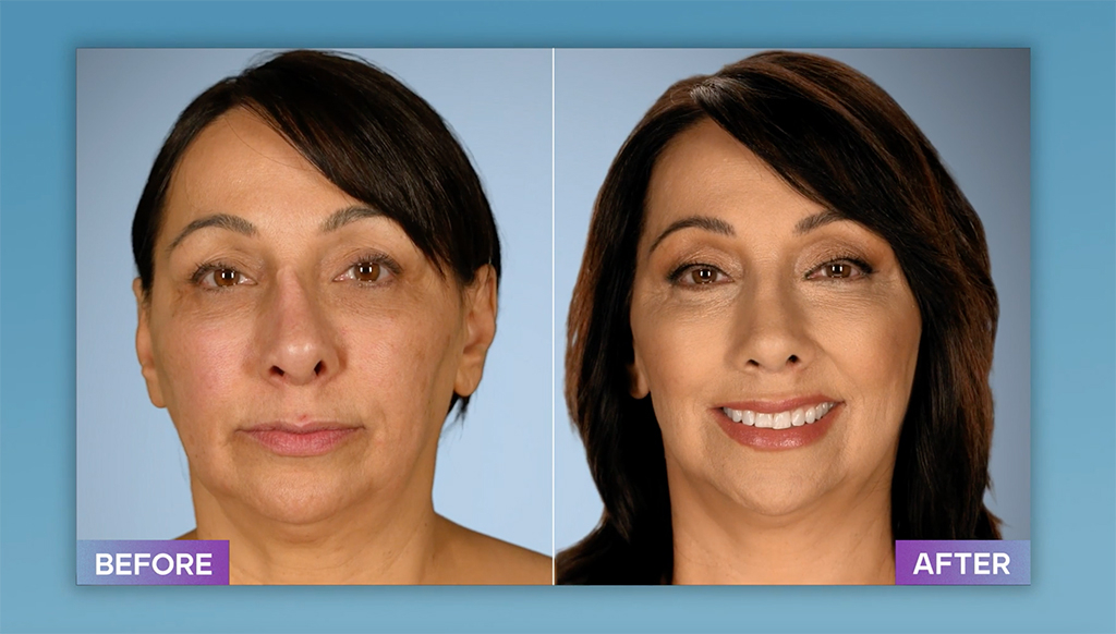 Botched': Do Dr. Dubrow and Dr. Nassif Have Their Own Plastic Surgery  Regrets?