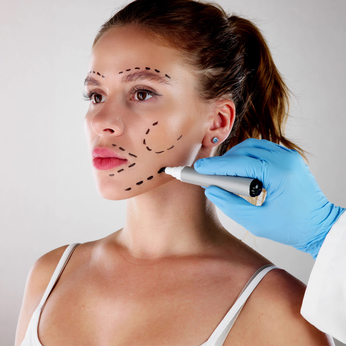 How to get rid of a cleft chin  American Society of Plastic Surgeons