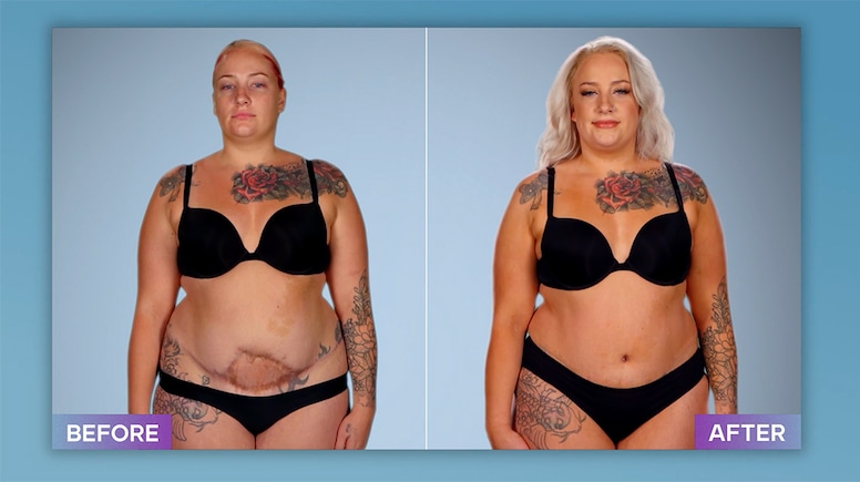 Photos from Botched Patients Before and After: Shocking Transformations!