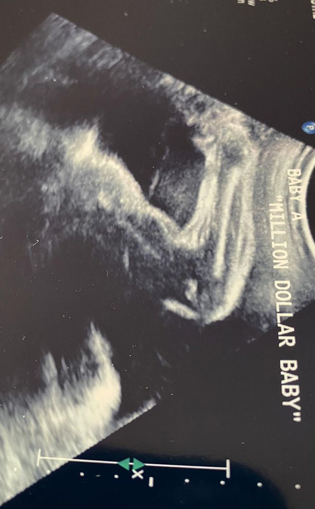 Hilary Swank, Ultrasound