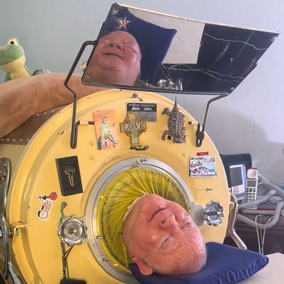 Paul Alexander, Who Spent 70 Years in an Iron Lung, Dead at 78