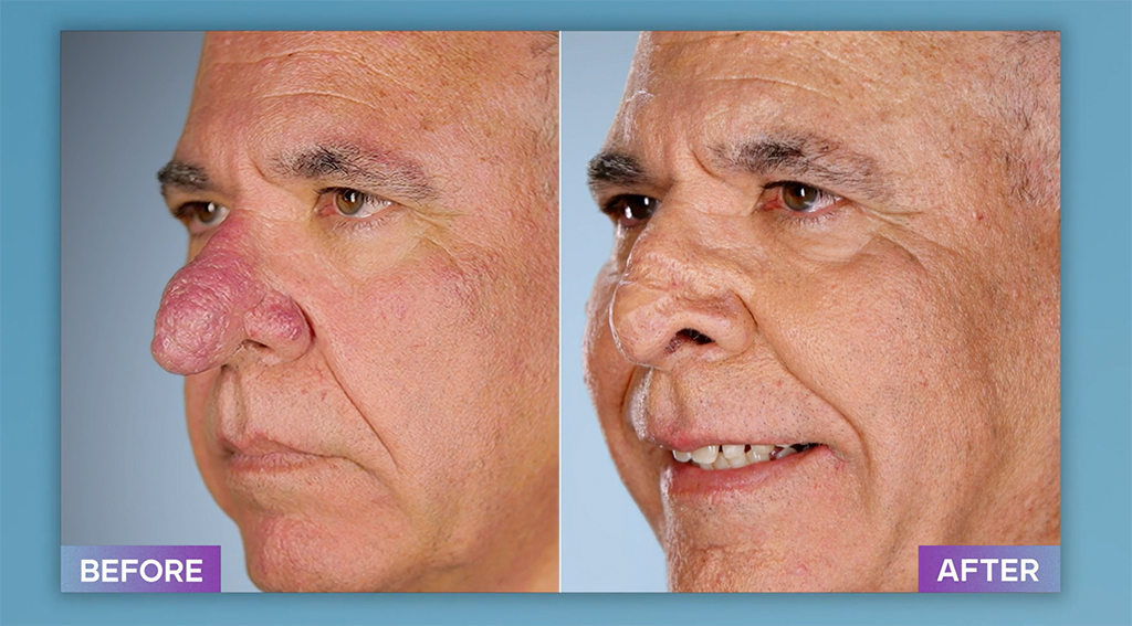 Photos from Botched Patients Before and After: Shocking