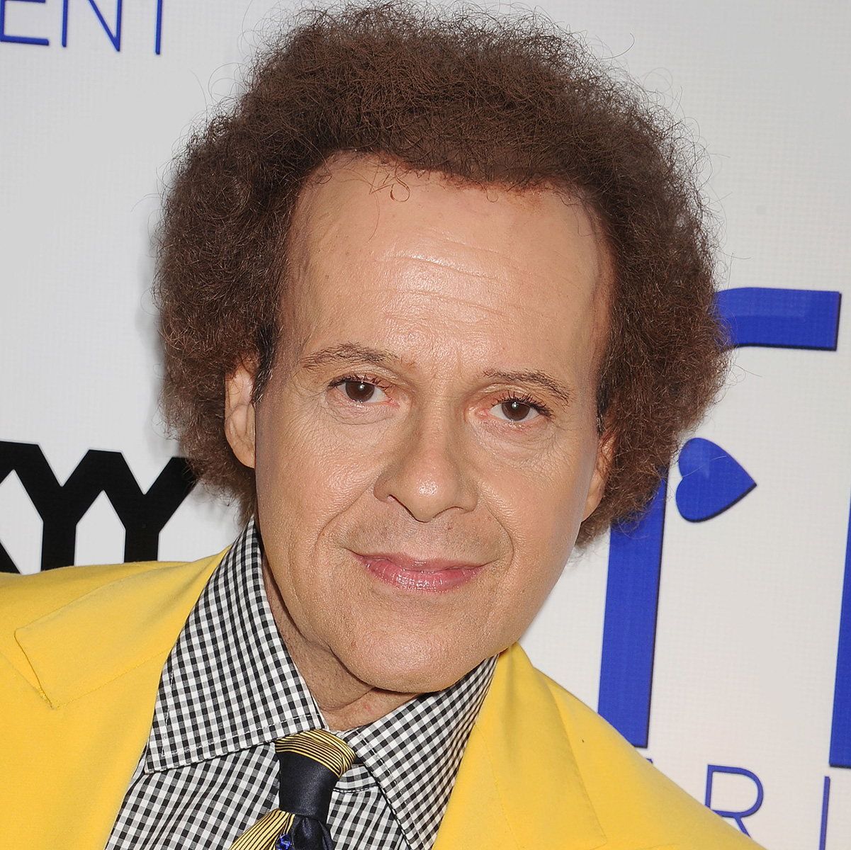 Fitness personality Richard Simmons reveals skin cancer diagnosis