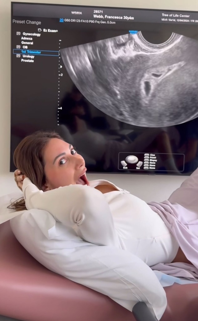 Pregnant Francesca Farago and Jesse Sullivan Reveal Sex of Twin Babies