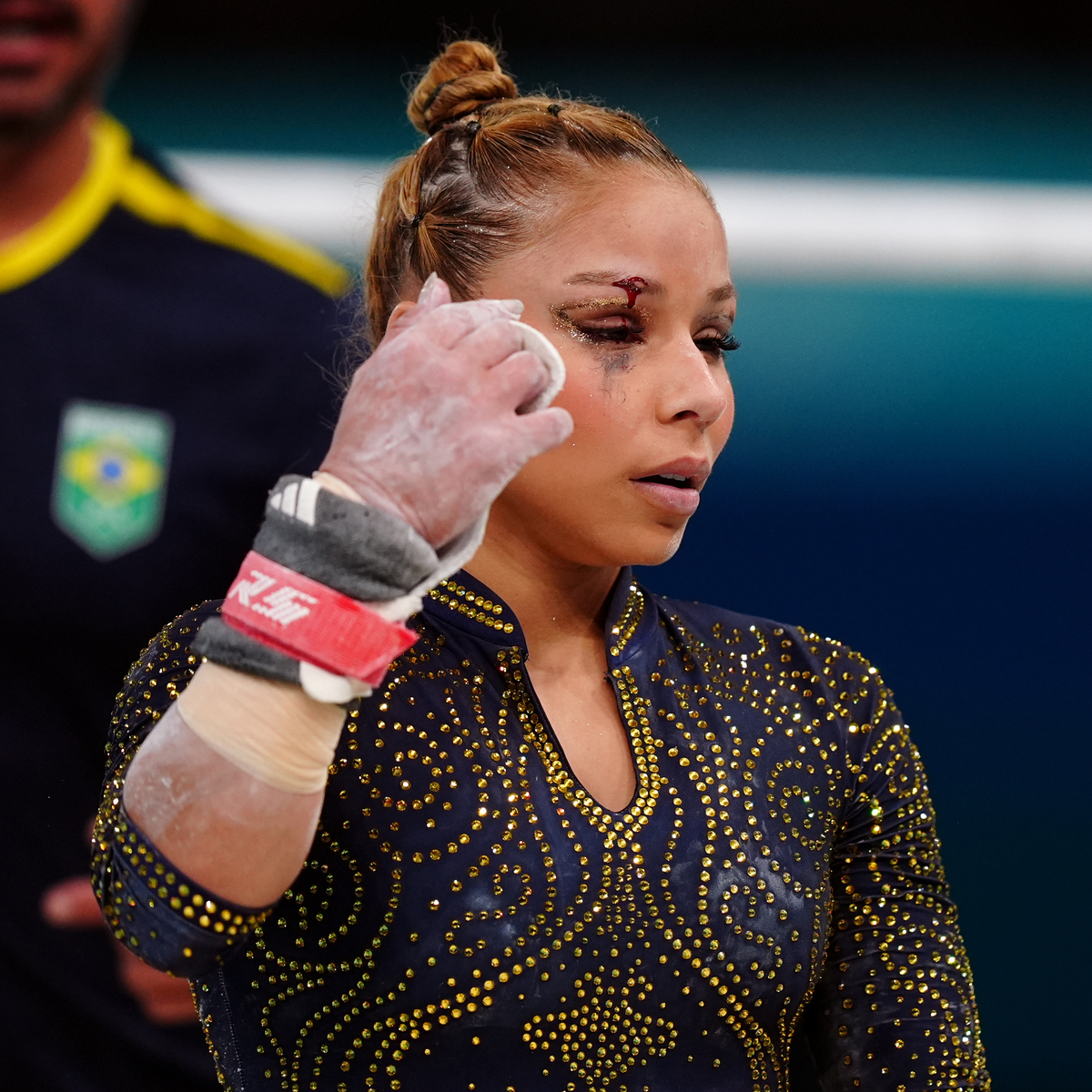 Brazilian Gymnast Flavia Saraiva Competes With Black Eye After Fall