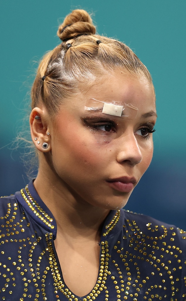 La gimnasta brasileña Flavia Saraiva compite con un ojo morado tras una caída