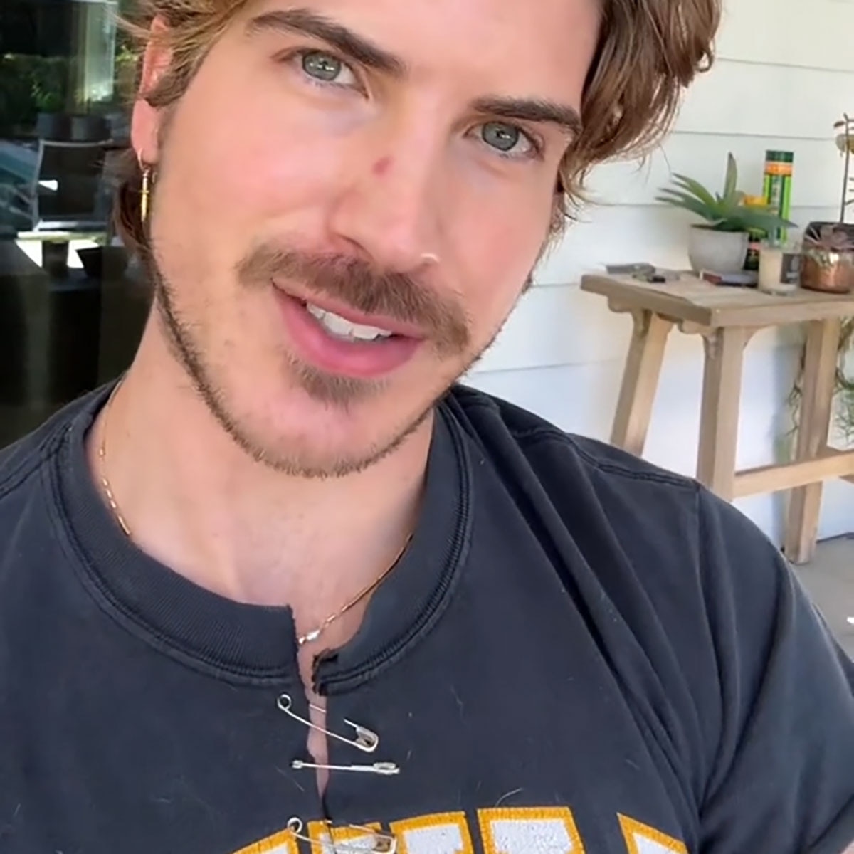 YouTuber Joey Graceffa teilt die Hautkrebsdiagnose