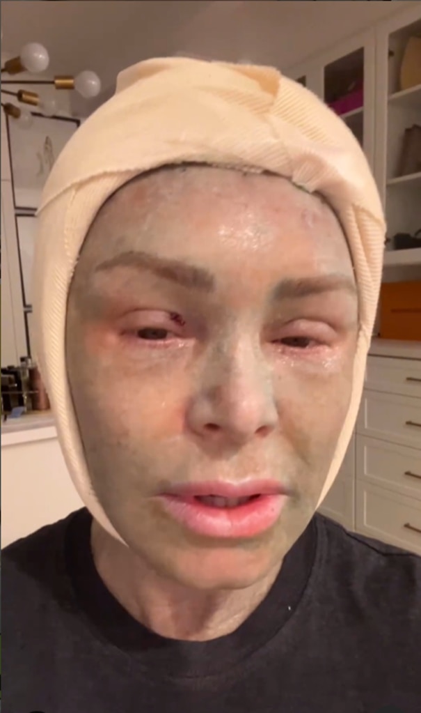 RHOC’s Tamra Judge Looks Unrecognizable After Cosmetic Procedure