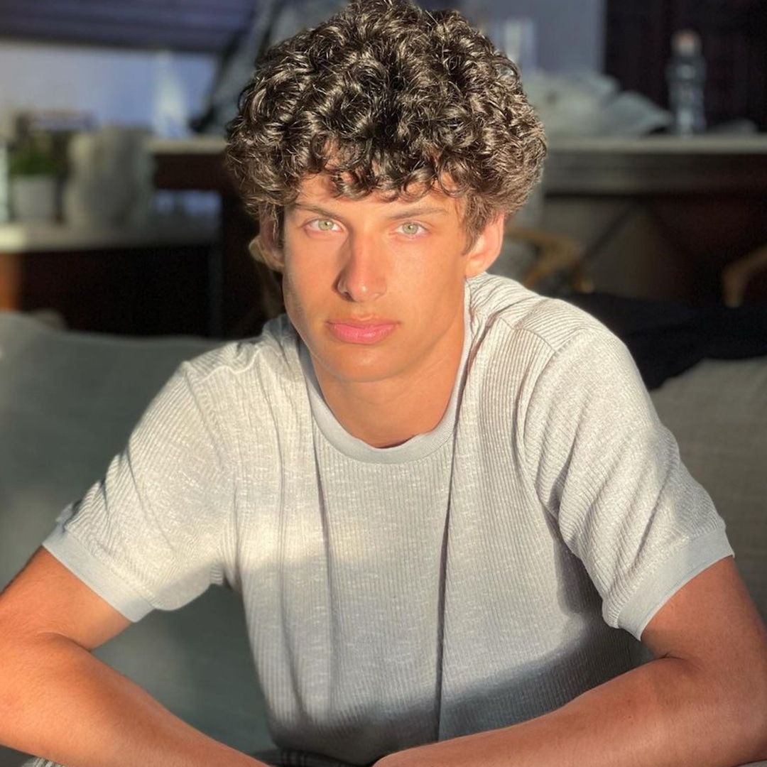 MILF Manor’s Joey Burford Gets Facial Reconstruction After Accident MILF Manor’s Joey Burford Gets Facial Reconstruction After Accident