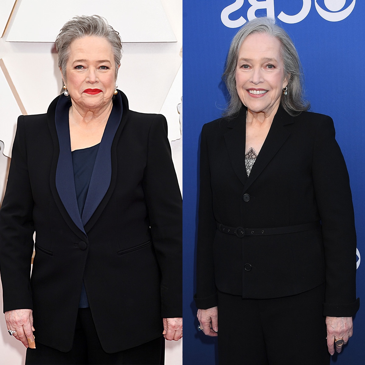 Kathy Bates aborda rumores de Ozempic após 100 libras. Perda de peso