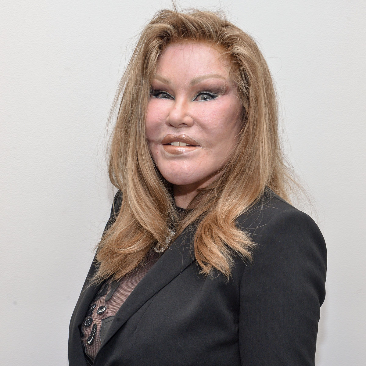 Jocelyn Wildenstein, Known for “Catwoman” Transformation, Dead at 84