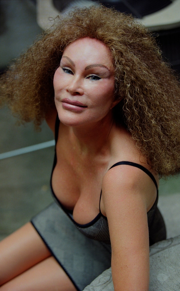 Todesursache der Prominenten Jocelyn Wildenstein enthüllt