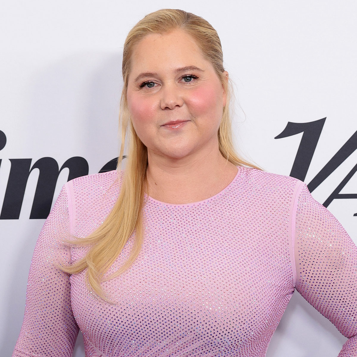 Amy Schumer Mengatakan Pernyataan “Wajah Bulan” Menyebabkan Diagnosis Sindrom Cushing