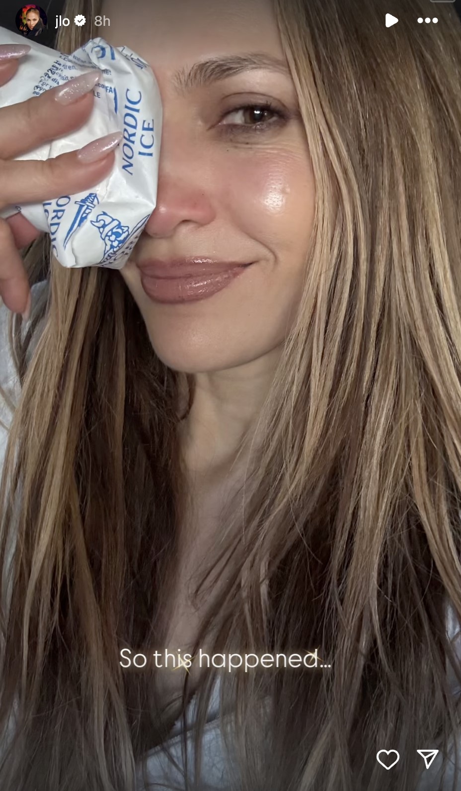 Jennifer Lopez AMAs Injury