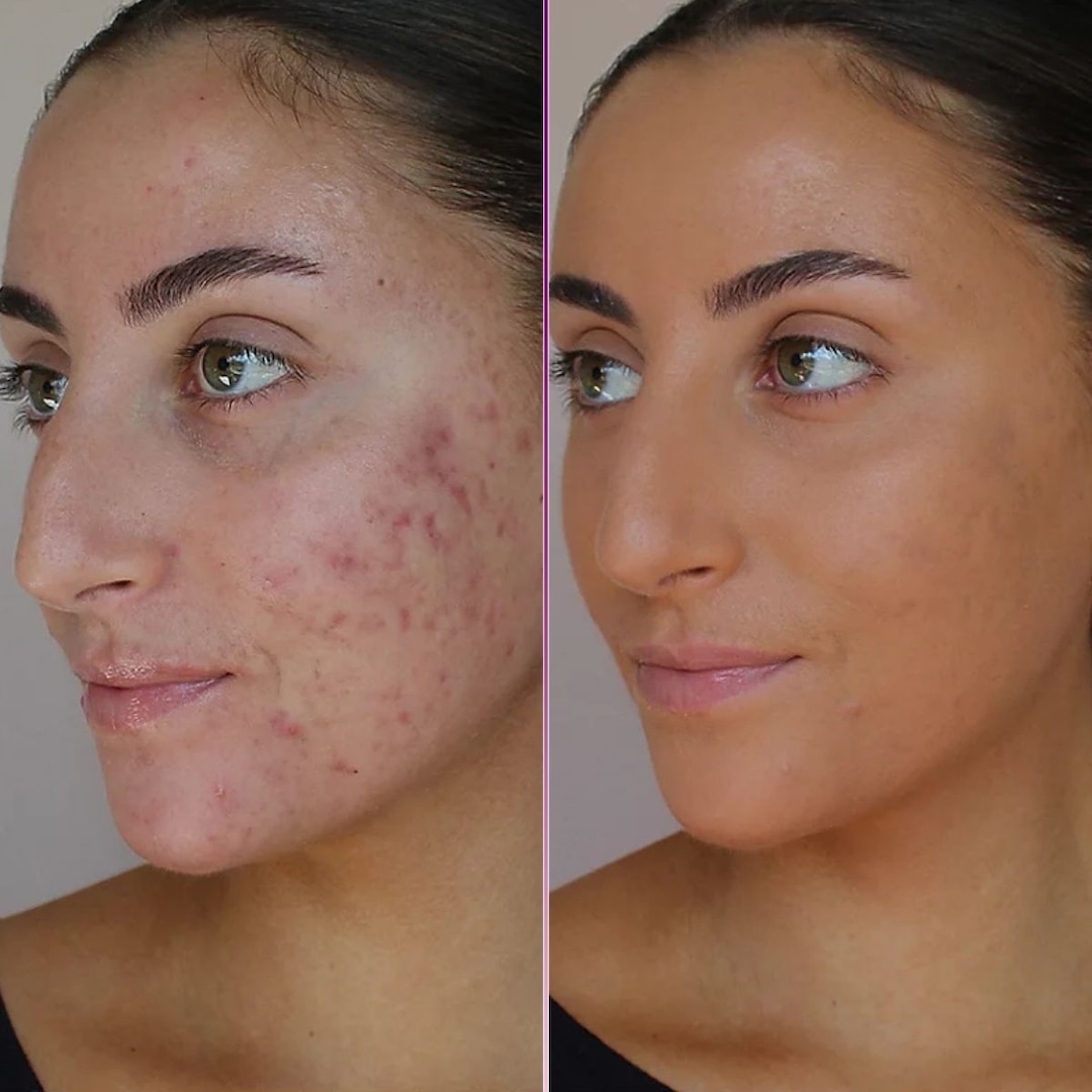 24-Hour Flash Deal: Get 57% Off Doll 10 Foundation That Beats Any Photo Filter 24-Hour Flash Deal: Get 57% Off Doll 10 Foundation That Beats Any Photo Filter