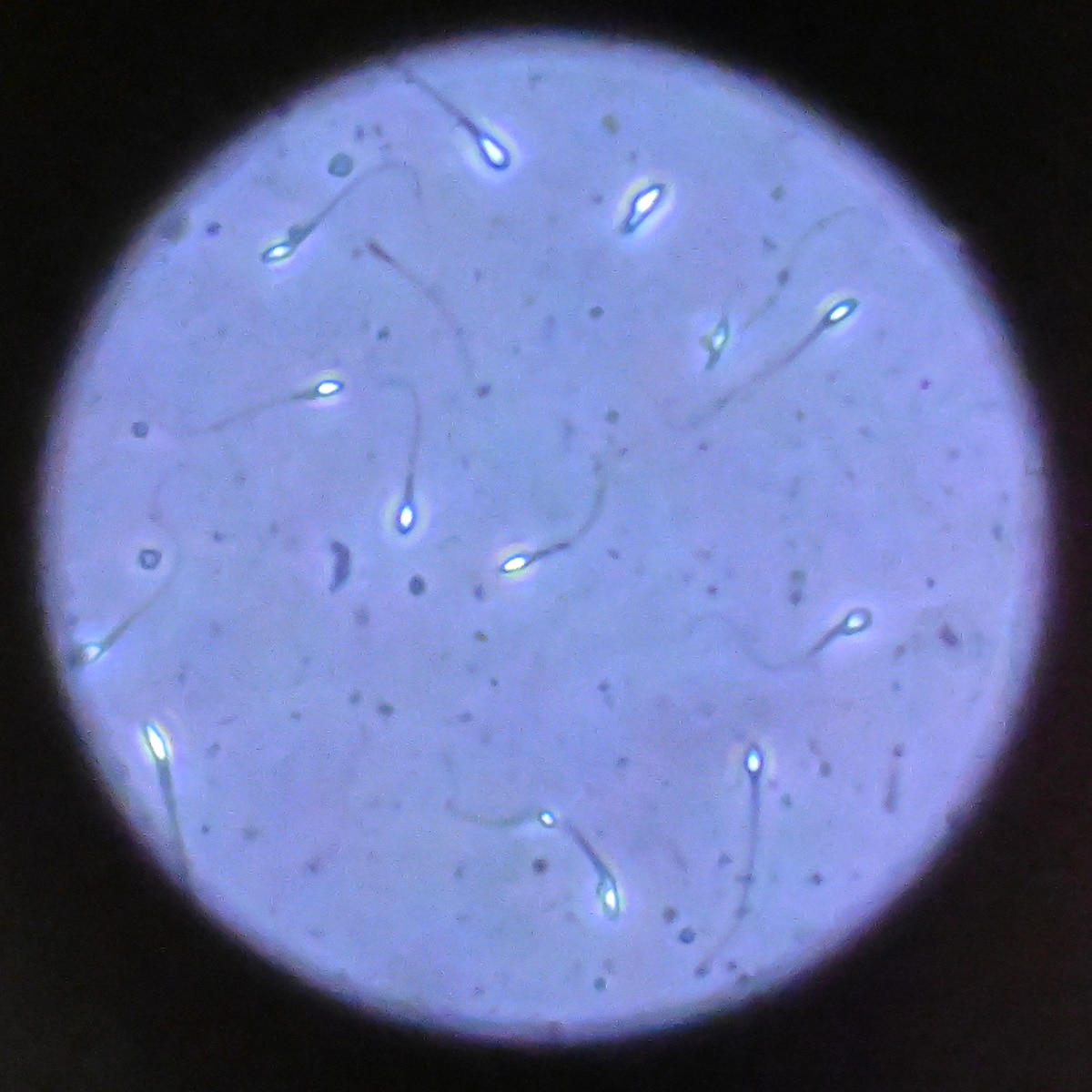 Sperm Donation, Microscope