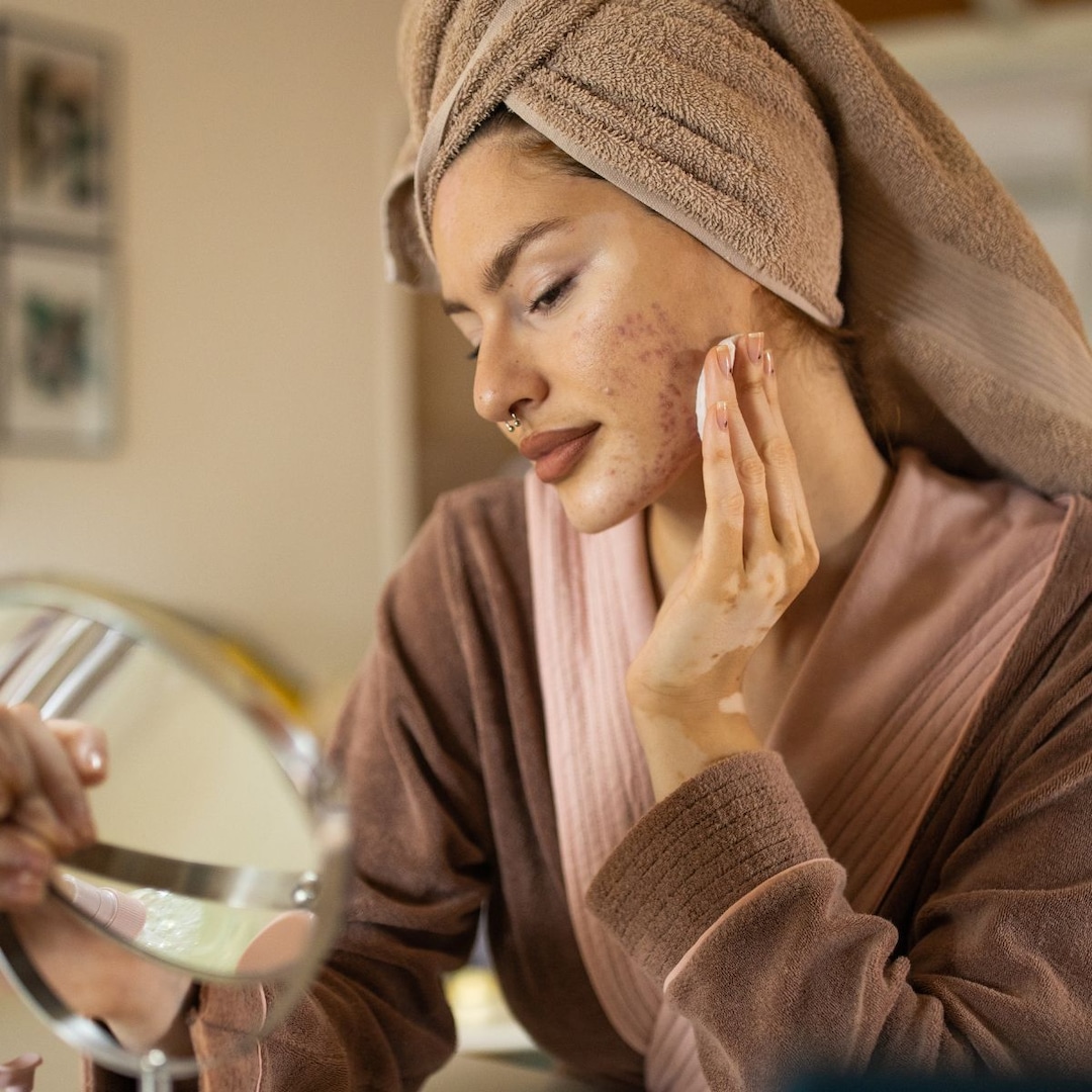 Stop Getting Breakouts When You Fly! Avoid Airplane Acne With This Derm Advice Stop Getting Breakouts When You Fly! Avoid Airplane Acne With This Derm Advice