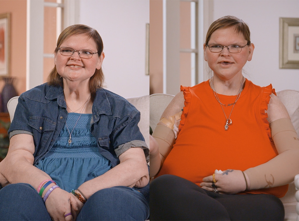 6/10 EMBARGO -- Tammy Slaton, 1000-Lb Sisters, skin removal surgery
