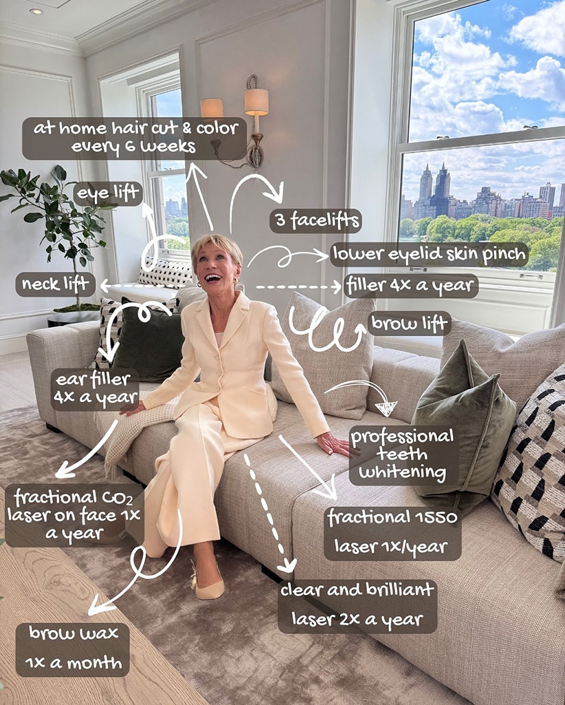 Barbara Corcoran details her plastic surgery and other cosmetic procedures on Instagram, 2025