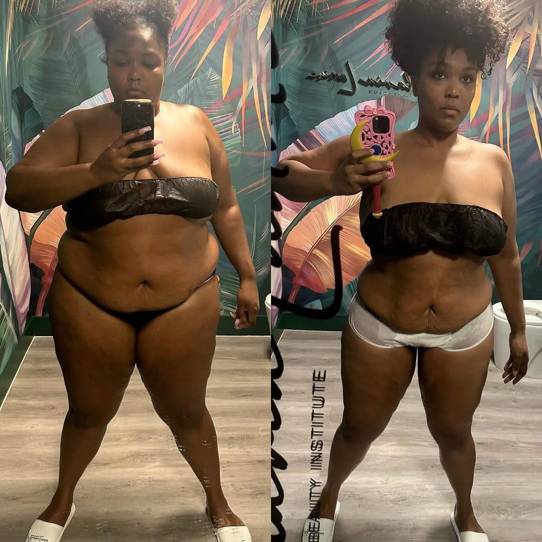 Social Media Bullying, Trolling, Shaming and Skinny Fat - Lizzo Before and After Weight Loss