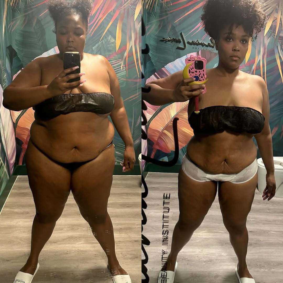 Social Media Bullying, Trolling, Shaming and Skinny Fat - Lizzo Before and After Weight Loss Social Media Bullying, Trolling, Shaming and Skinny Fat - Lizzo Before and After Weight Loss