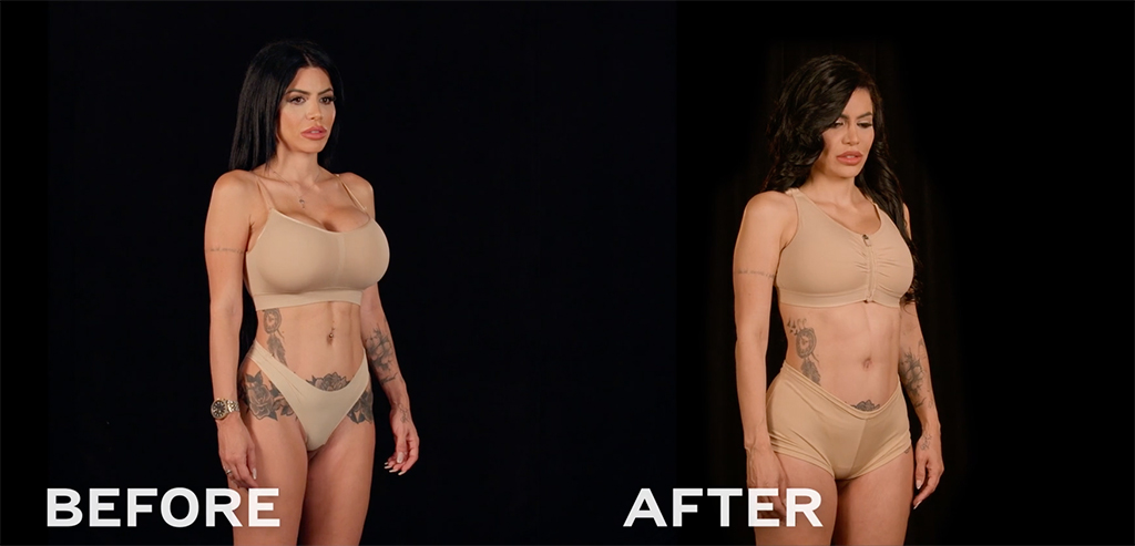Botched Presents: Plastic Surgery Rewind Before & After Photos