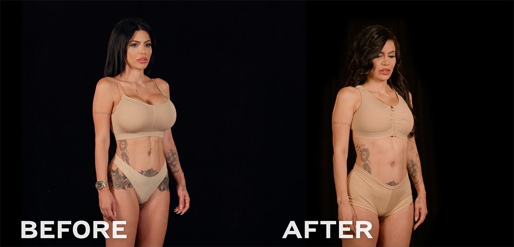 Botched Presents: Plastic Surgery Rewind Before & After Photos
