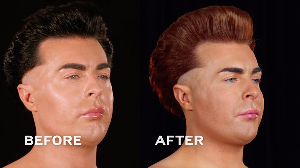 Botched Presents: Plastic Surgery Rewind Before & After Photos