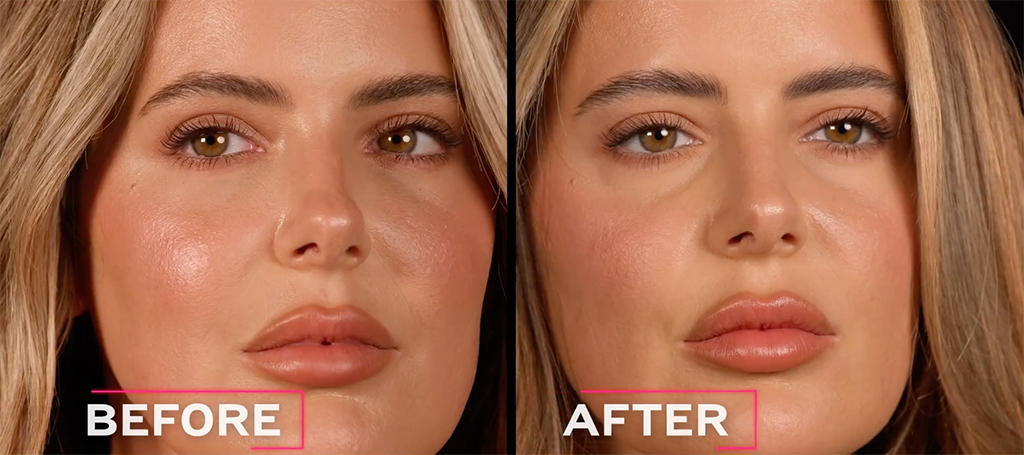Botched Presents: Plastic Surgery Rewind Before & After Photos