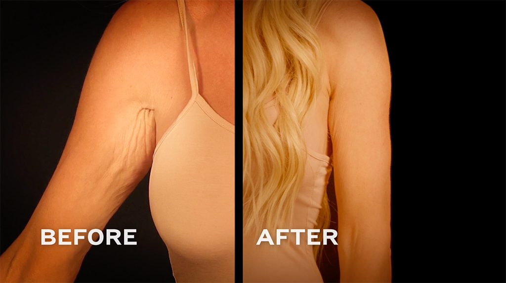 Botched Presents: Plastic Surgery Rewind Before & After Photos