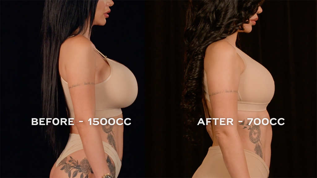Botched Presents: Plastic Surgery Rewind Before & After Photos
