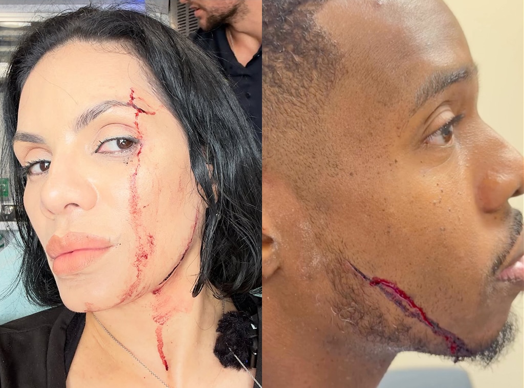 TikTokers NinaUnrated, Patrick Blackwood Hit by Car at Restaurant