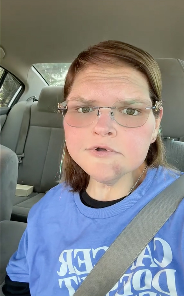 Tammy Slaton Bruise, TikTok