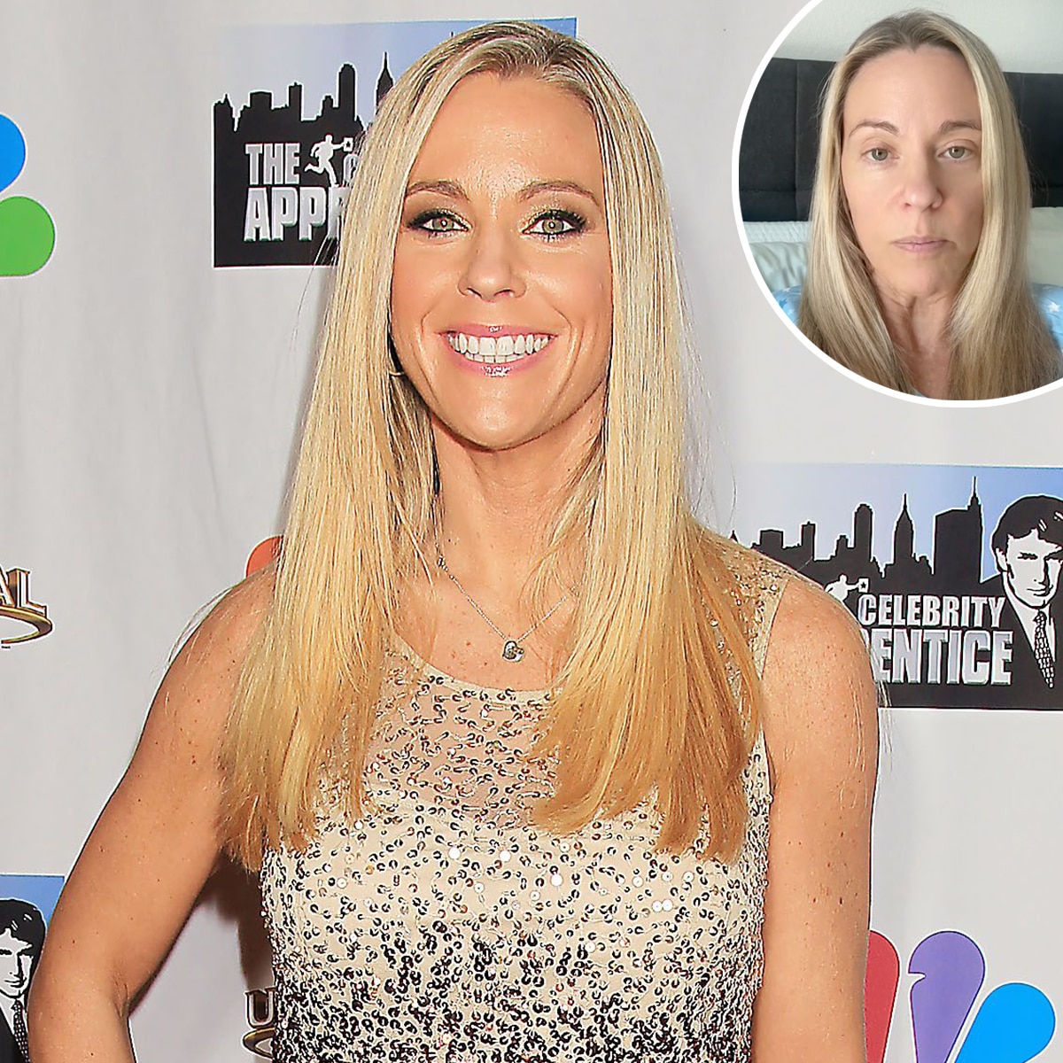 Kate Gosselin Shares Recovery Journey After Life-Altering Surgery